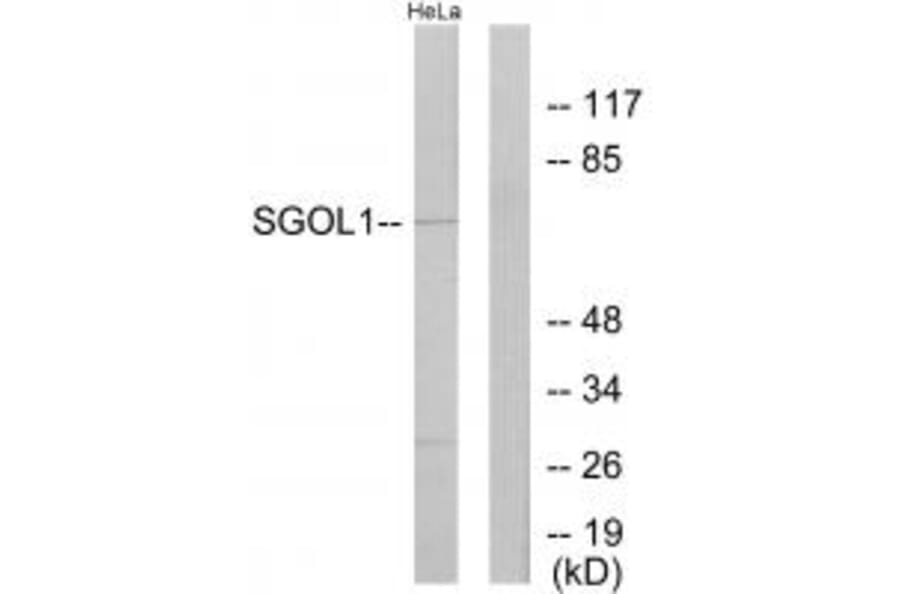 Western blot - SGOL1 Antibody from Signalway Antibody (33926) - Antibodies.com