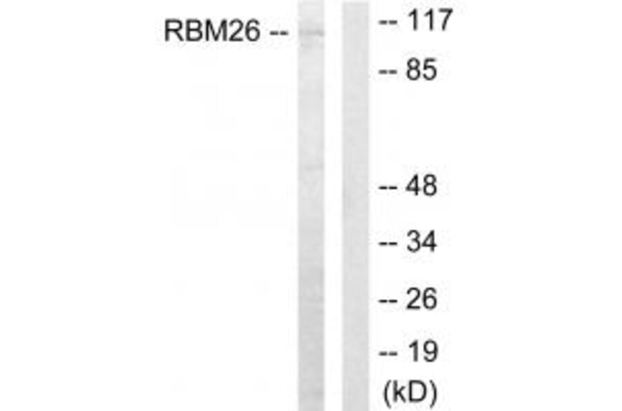 Western blot - RBM26 Antibody from Signalway Antibody (33929) - Antibodies.com