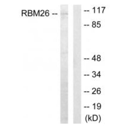 Western blot - RBM26 Antibody from Signalway Antibody (33929) - Antibodies.com