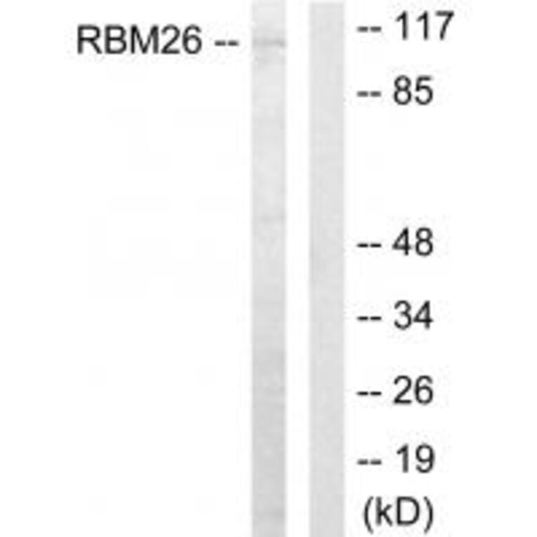 Western blot - RBM26 Antibody from Signalway Antibody (33929) - Antibodies.com