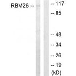 Western blot - RBM26 Antibody from Signalway Antibody (33929) - Antibodies.com