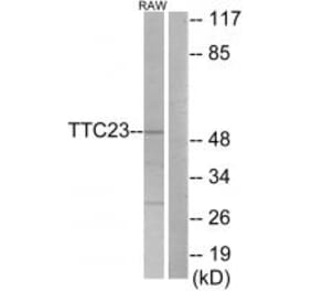 Western blot - TTC23 Antibody from Signalway Antibody (33931) - Antibodies.com