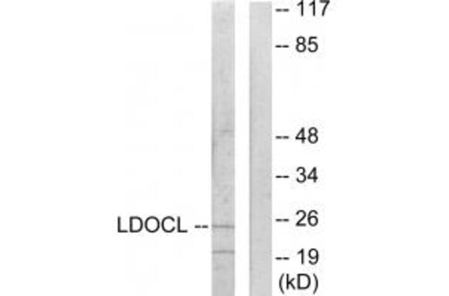 Western blot - LDOCL Antibody from Signalway Antibody (33934) - Antibodies.com