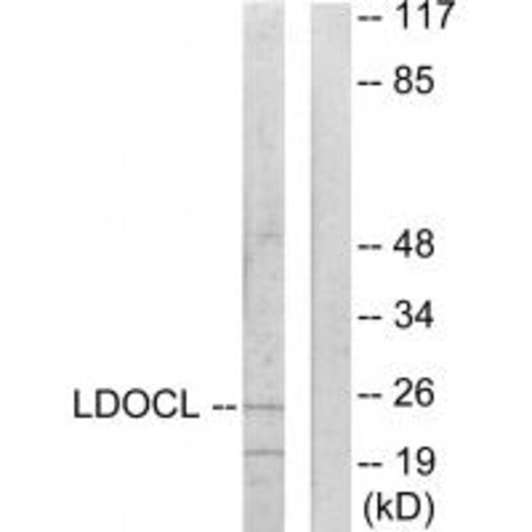 Western blot - LDOCL Antibody from Signalway Antibody (33934) - Antibodies.com
