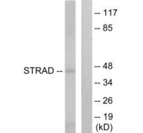 Western blot - STRAD Antibody from Signalway Antibody (33947) - Antibodies.com