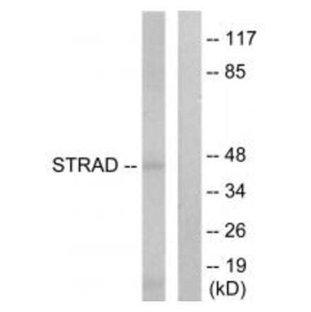 Western blot - STRAD Antibody from Signalway Antibody (33947) - Antibodies.com