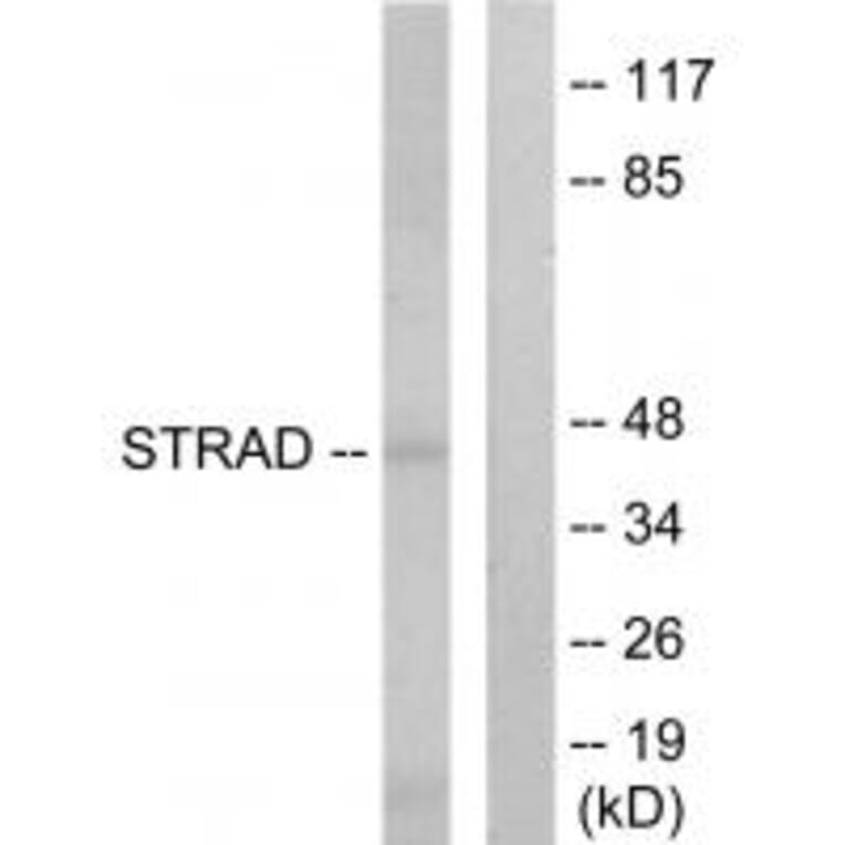 Western blot - STRAD Antibody from Signalway Antibody (33947) - Antibodies.com