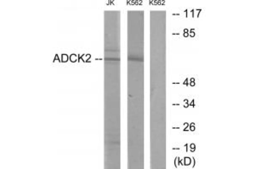 Western blot - ADCK2 Antibody from Signalway Antibody (33948) - Antibodies.com