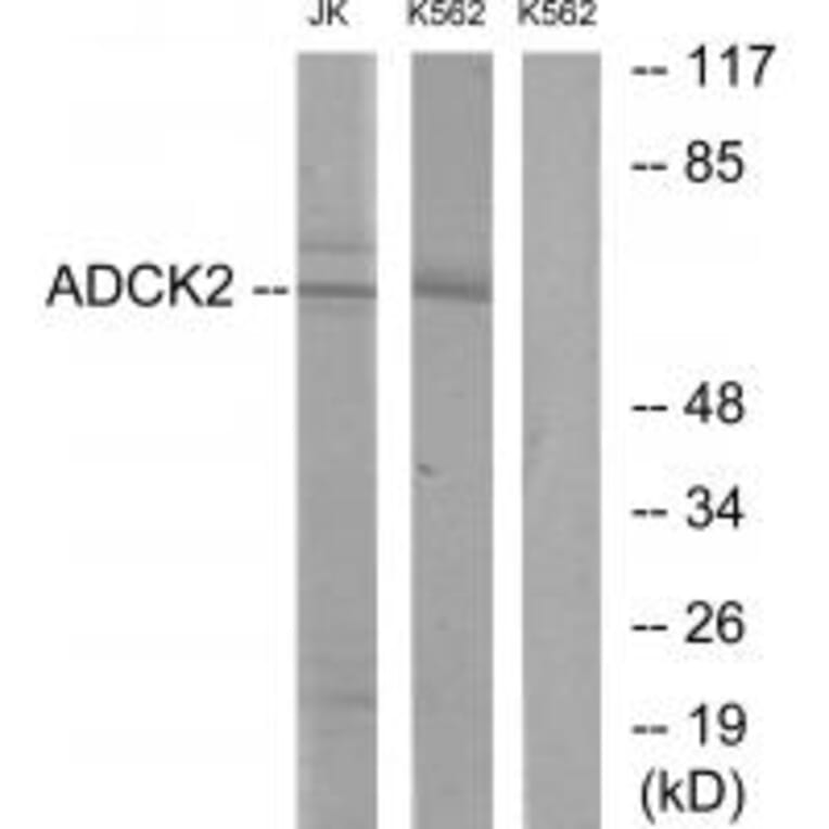 Western blot - ADCK2 Antibody from Signalway Antibody (33948) - Antibodies.com