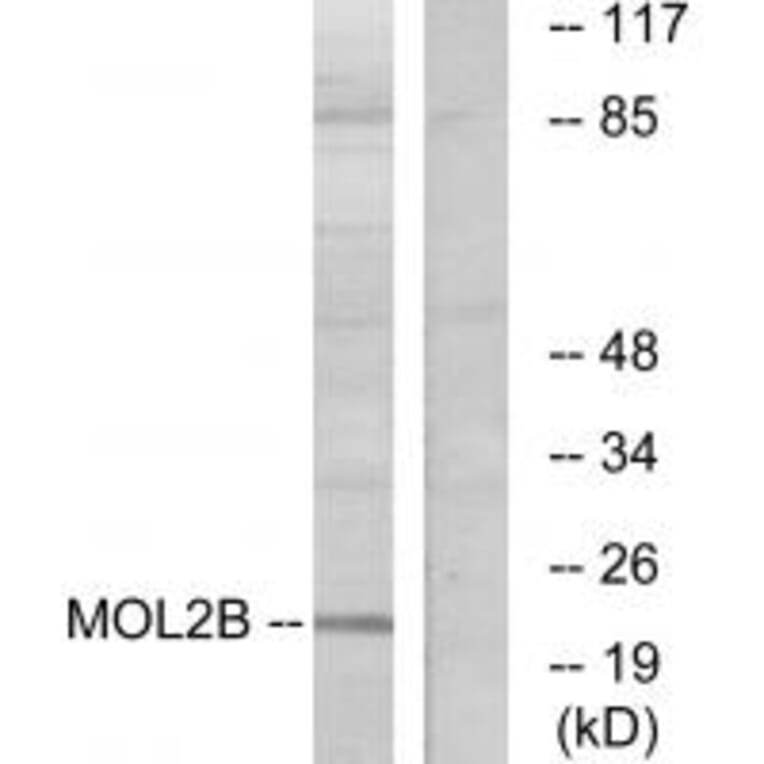 Western blot - MOL2B Antibody from Signalway Antibody (33950) - Antibodies.com