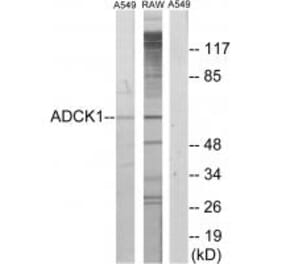 Western blot - ADCK1 Antibody from Signalway Antibody (33952) - Antibodies.com