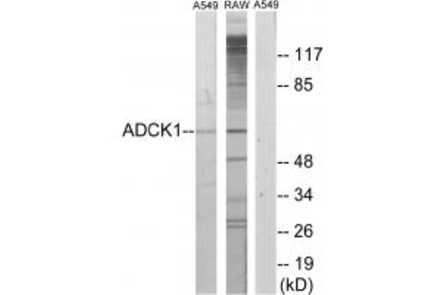 Western blot - ADCK1 Antibody from Signalway Antibody (33952) - Antibodies.com
