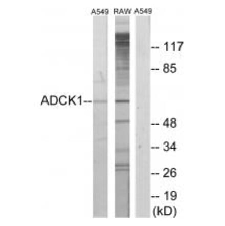 Western blot - ADCK1 Antibody from Signalway Antibody (33952) - Antibodies.com