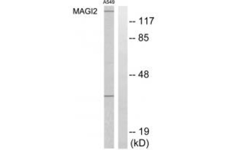 Western blot - MAGI2 Antibody from Signalway Antibody (33953) - Antibodies.com