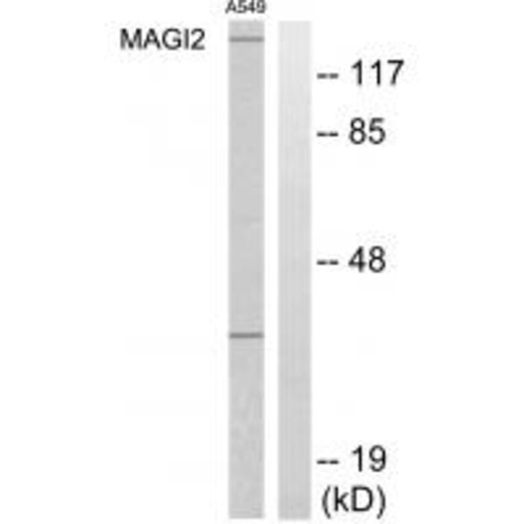 Western blot - MAGI2 Antibody from Signalway Antibody (33953) - Antibodies.com