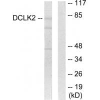 Western blot analysis of extracts from HepG2 cells, using DCLK2 antibody #33967.