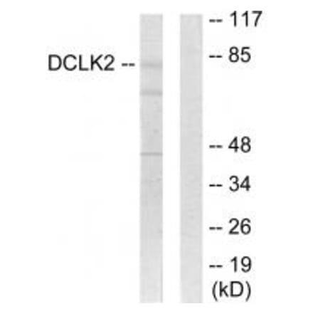 Western blot - DCLK2 Antibody from Signalway Antibody (33967) - Antibodies.com