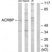 Western blot analysis of extracts from 293 cells, HepG2 cells and Jurkat cells, using ACRBP antibody #33972.