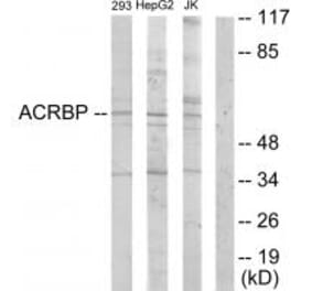 Western blot - ACRBP Antibody from Signalway Antibody (33972) - Antibodies.com