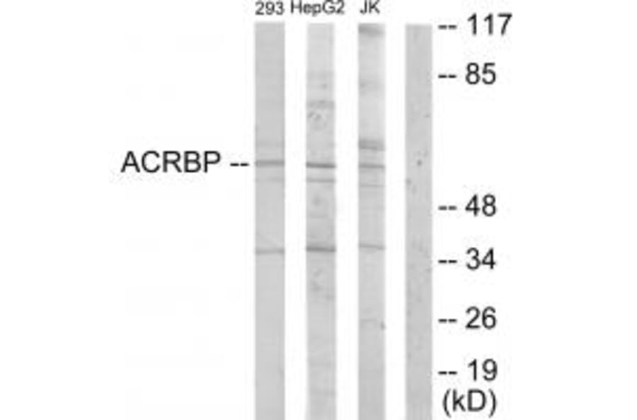 Western blot - ACRBP Antibody from Signalway Antibody (33972) - Antibodies.com