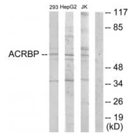 Western blot - ACRBP Antibody from Signalway Antibody (33972) - Antibodies.com