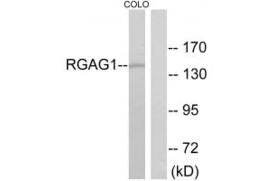 Western blot - RGAG1 Antibody from Signalway Antibody (33974) - Antibodies.com