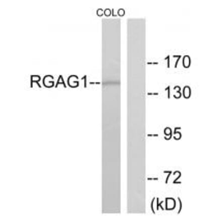 Western blot - RGAG1 Antibody from Signalway Antibody (33974) - Antibodies.com