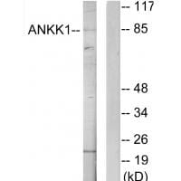 Western blot analysis of extracts from HeLa cells, using ANKK1 antibody #33977.