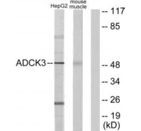 Western blot - ADCK3 Antibody from Signalway Antibody (33981) - Antibodies.com