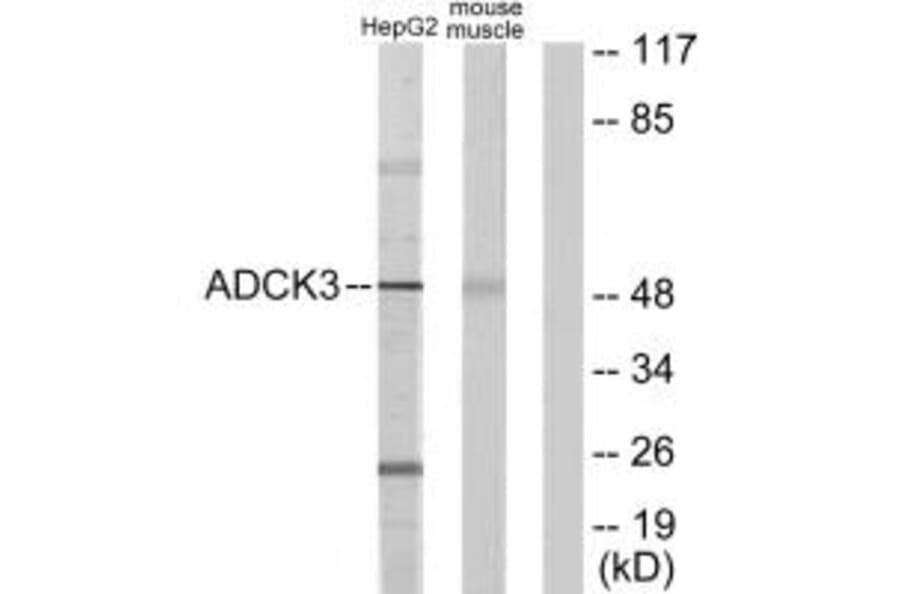 Western blot - ADCK3 Antibody from Signalway Antibody (33981) - Antibodies.com