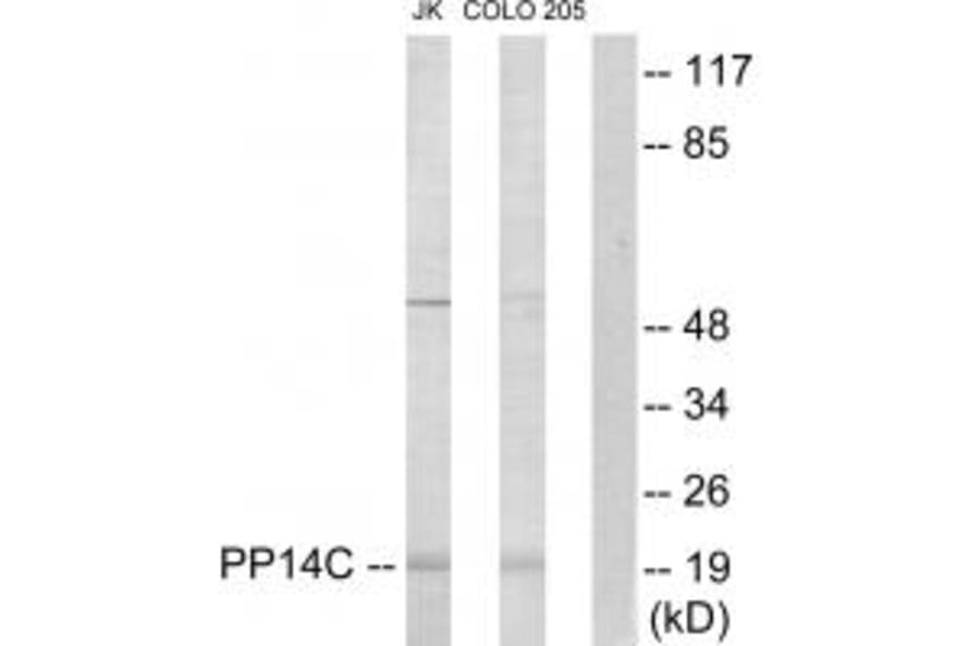 Western blot - PP14C Antibody from Signalway Antibody (33982) - Antibodies.com