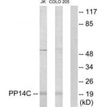 Western blot - PP14C Antibody from Signalway Antibody (33982) - Antibodies.com