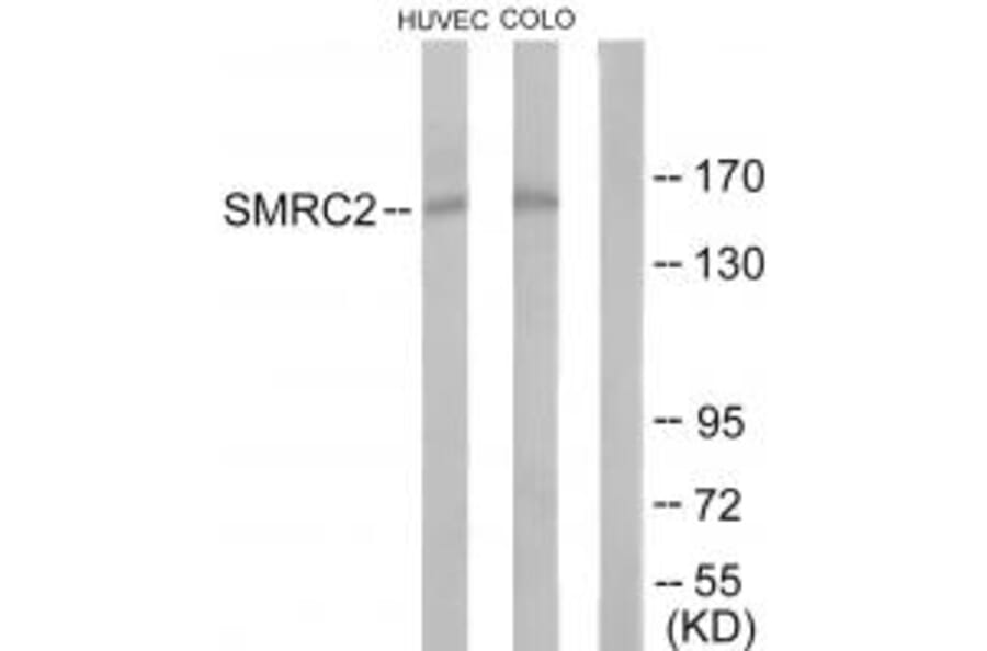Western blot - SMRC2 Antibody from Signalway Antibody (33984) - Antibodies.com