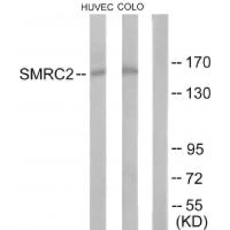 Western blot - SMRC2 Antibody from Signalway Antibody (33984) - Antibodies.com