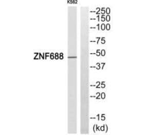 Western blot - ZNF688 Antibody from Signalway Antibody (33996) - Antibodies.com
