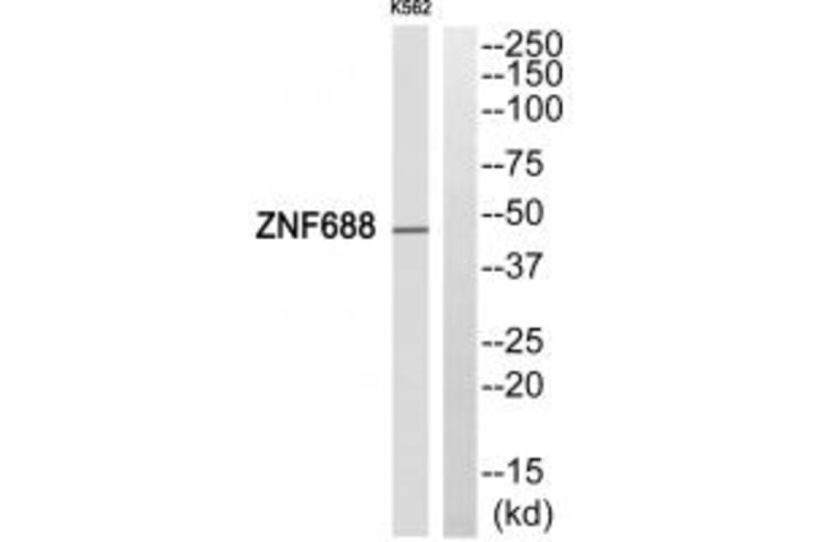Western blot - ZNF688 Antibody from Signalway Antibody (33996) - Antibodies.com