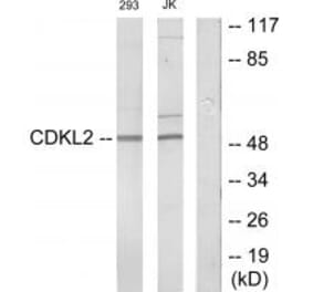 Western blot - CDKL2 Antibody from Signalway Antibody (34005) - Antibodies.com