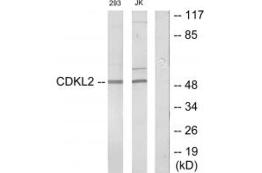 Western blot - CDKL2 Antibody from Signalway Antibody (34005) - Antibodies.com