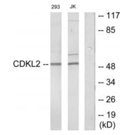 Western blot - CDKL2 Antibody from Signalway Antibody (34005) - Antibodies.com