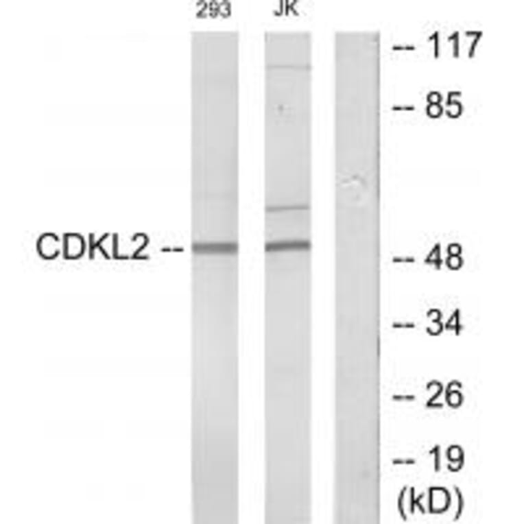 Western blot - CDKL2 Antibody from Signalway Antibody (34005) - Antibodies.com