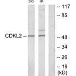 Western blot - CDKL2 Antibody from Signalway Antibody (34005) - Antibodies.com