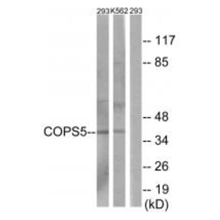 Western blot - COPS5 Antibody from Signalway Antibody (34008) - Antibodies.com