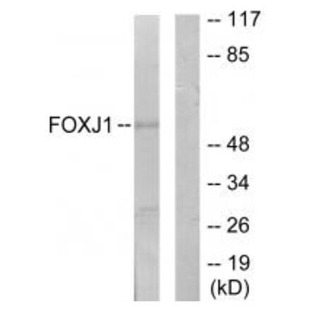 Western blot - FOXJ1 Antibody from Signalway Antibody (34010) - Antibodies.com