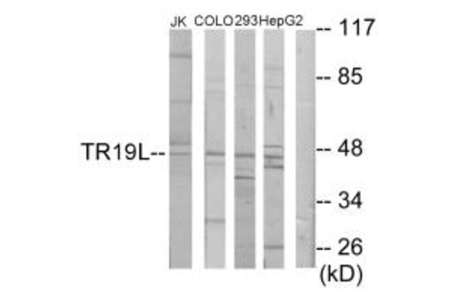Western blot - TR19L Antibody from Signalway Antibody (34020) - Antibodies.com
