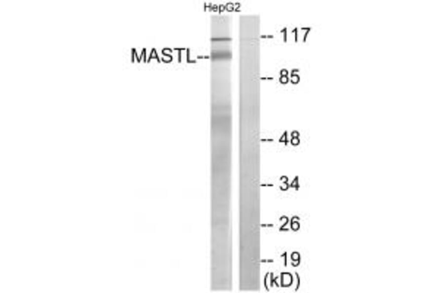 Western blot - MASTL Antibody from Signalway Antibody (34029) - Antibodies.com