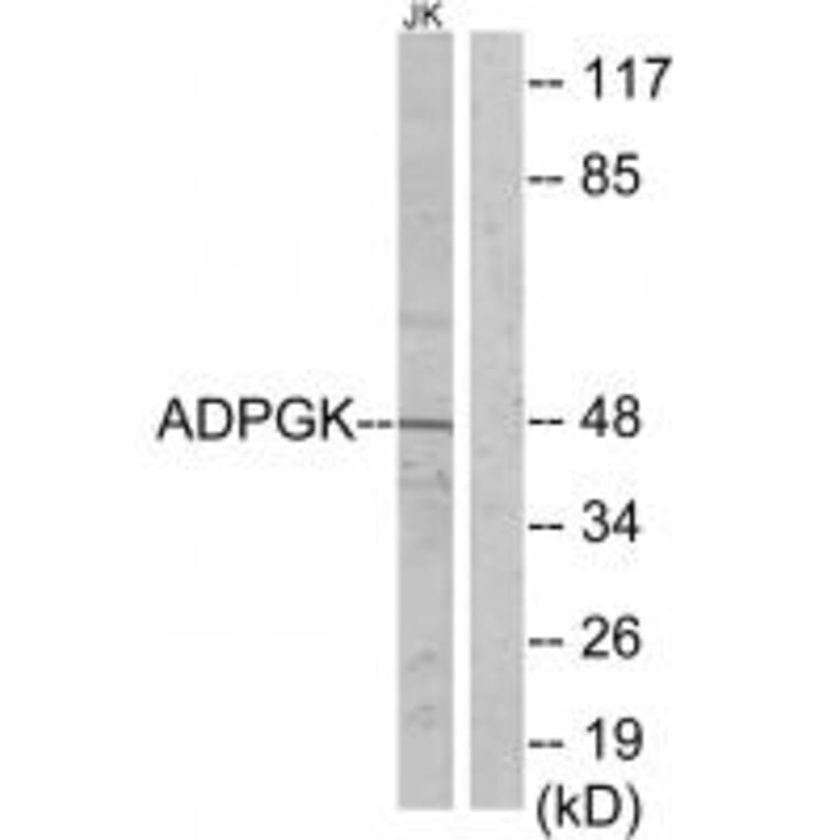 Western blot - ADPGK Antibody from Signalway Antibody (34043) - Antibodies.com