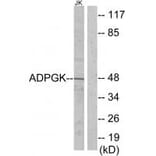 Western blot - ADPGK Antibody from Signalway Antibody (34043) - Antibodies.com