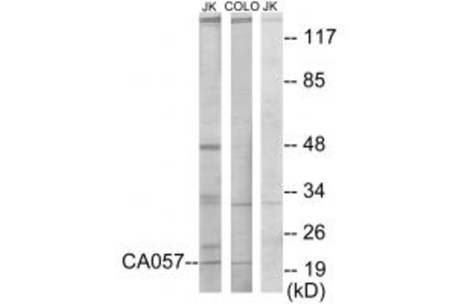 Western blot - CA057 Antibody from Signalway Antibody (34044) - Antibodies.com