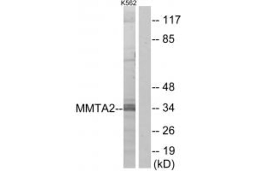Western blot - MMTA2 Antibody from Signalway Antibody (34045) - Antibodies.com