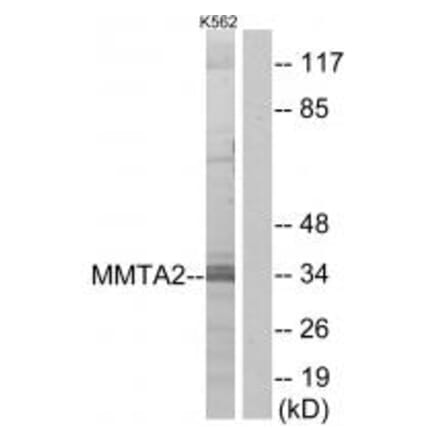 Western blot - MMTA2 Antibody from Signalway Antibody (34045) - Antibodies.com